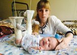 Малышу, которому на приёме у врача в Уссурийске сломали ножки, сняли гипс